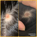 Samson Hair Growth Serum