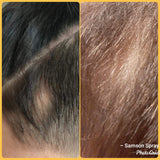 Samson Hair Growth Spray